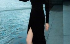 张雨绮腿部惊现淤痕