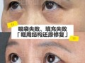 上眼眶部分凸起面相与眼下竖纹面相解析