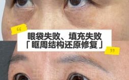 上眼眶部分凸起面相与眼下竖纹面相解析