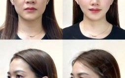 颧骨突出的女性