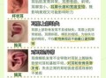 耳轮缺损面相，耳廓不全面相