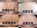 抬头纹深重如何改善 抬头纹深重的面相解析