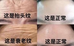 抬头纹深重如何改善 抬头纹深重的面相解析