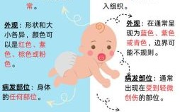 胎记的形成原因