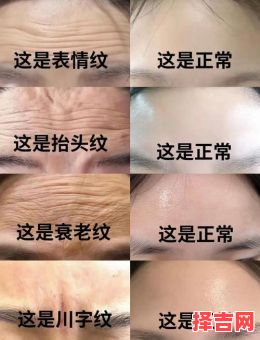 抬头纹深重如何改善 抬头纹深重的面相解析-第1张图片 抬头纹深重如何改善 抬头纹深重的面相解析-第1张图片