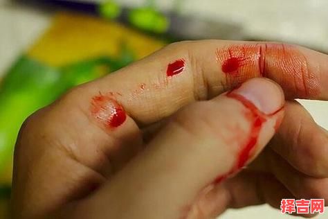 梦见他人流血-第1张图片