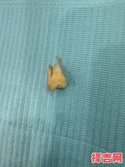 孕妇梦到牙齿脱落-第1张图片