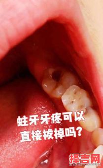 女人梦见牙齿坏了掉了有什么寓意 女人梦见拔掉蛀牙却不疼代表什么-第1张图片