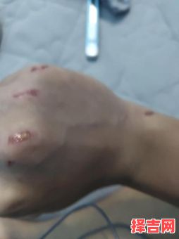 梦见斗殴负伤-第1张图片