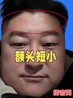 美人尖指的是什么-第1张图片 美人尖指的是什么-第1张图片