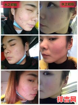 满脸生花是何意-第1张图片