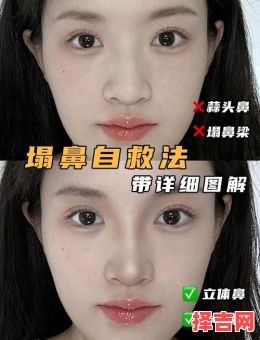 鼻唇沟如何去掉-第1张图片