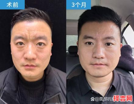 男人印堂川字纹面相 男人川字纹面相-第1张图片