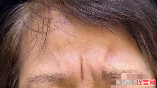 眉间八字纹看疤痕面相女子富豪看眉间纹-第1张图片